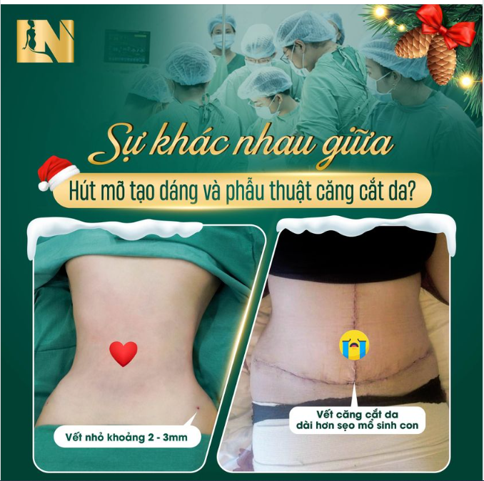 SỰ KHÁC NHAU GIỮA HÚT MỠ TẠO DÁNG VÀ PHẪU THUẬT CĂNG CẮT DA