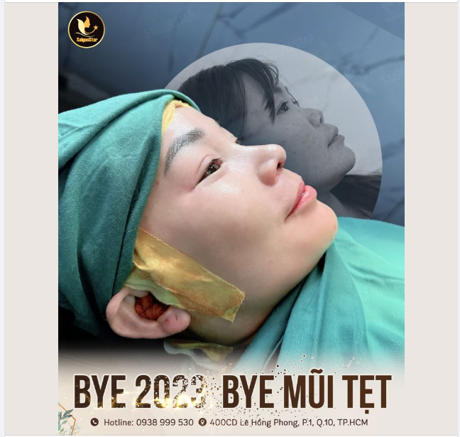BYE 2023 – BYE MŨI TẸT