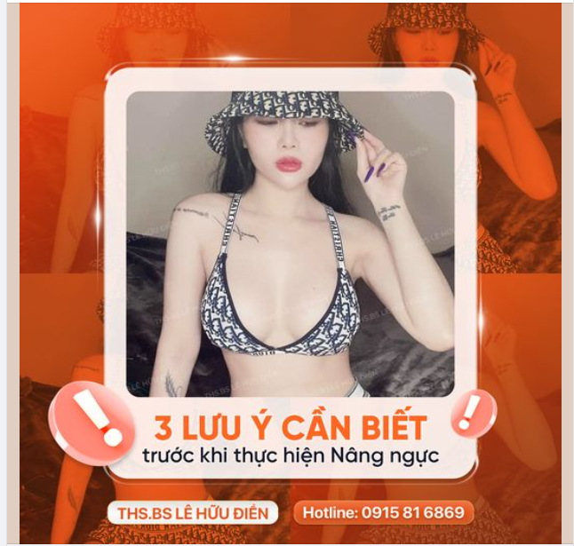 3 lưu ý khách hàng cần biết trước khi thực hiện Nâng ngực