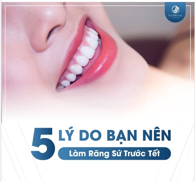 5 LÝ DO NÊN LÀM RĂNG SỨ TRƯỚC TẾT?