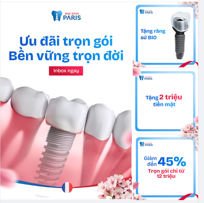 TRỒNG RĂNG IMPLANT - SALE 45% TẶNG THÊM 2 TRIỆU TIỀN MẶT