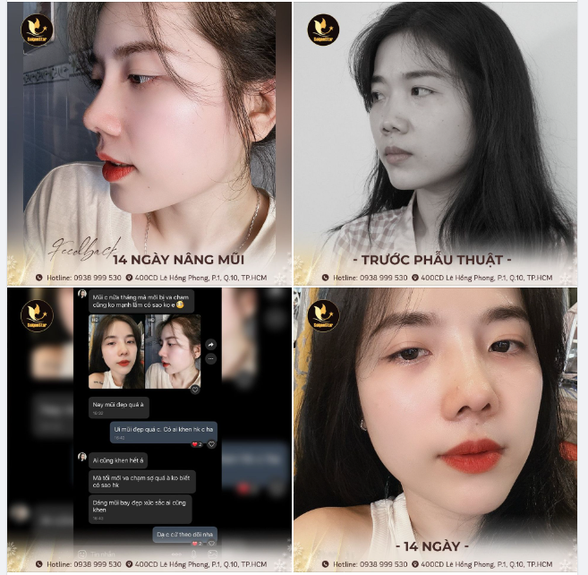 FEEDBACK 14 NGÀY NÂNG MŨI