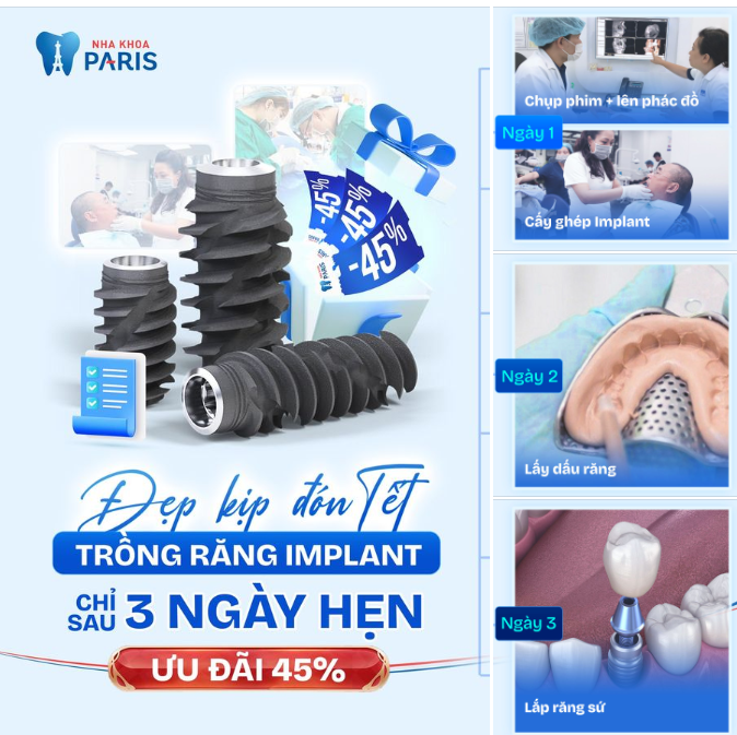RĂNG KHỎE ĐÓN TẾT CHỈ SAU 3 LẦN HẸN