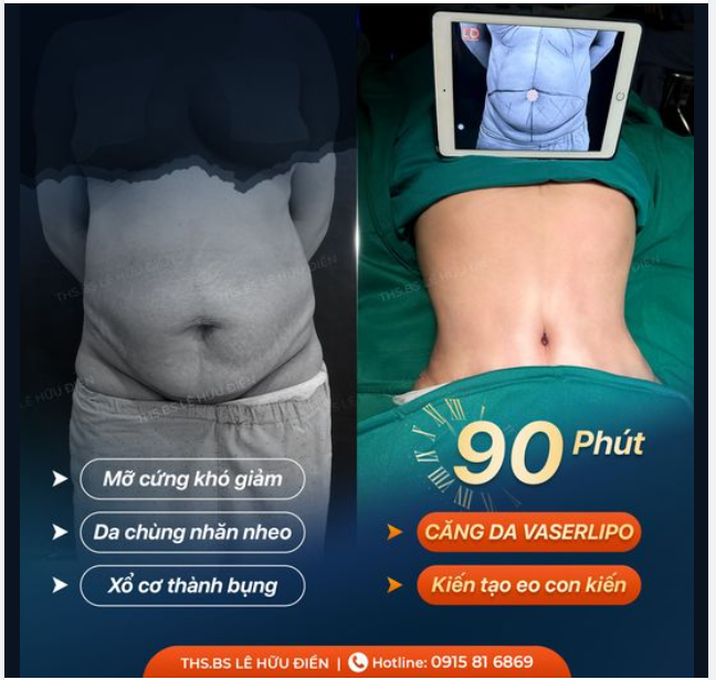 82 KIẾP NẠN CỦA PHỤ NỮ SAU SINH