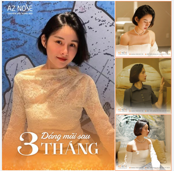 Makeup artist: Gấp đôi visual sau 3 tháng nâng mũi