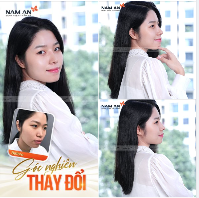 THAY ĐỔI GÓC NGHIÊNG - GƯƠNG MẶT THANH THOÁT