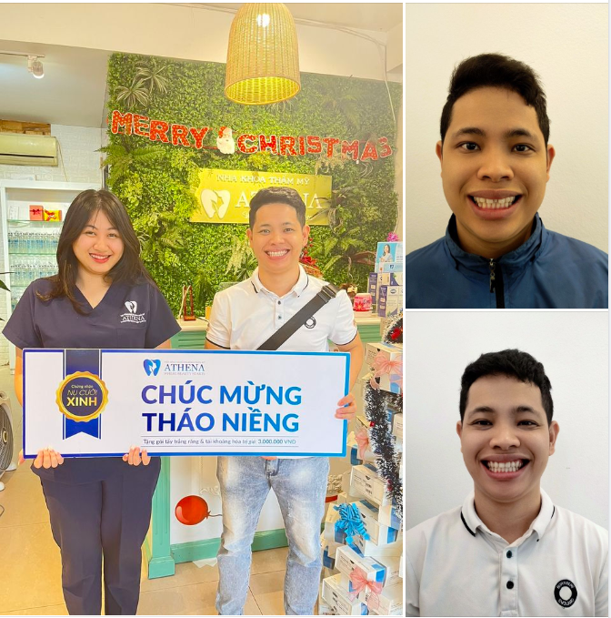 Chúc mừng Nguyễn Gia Đạt vừa hoàn thành hành trình tháo niềng thành công!
