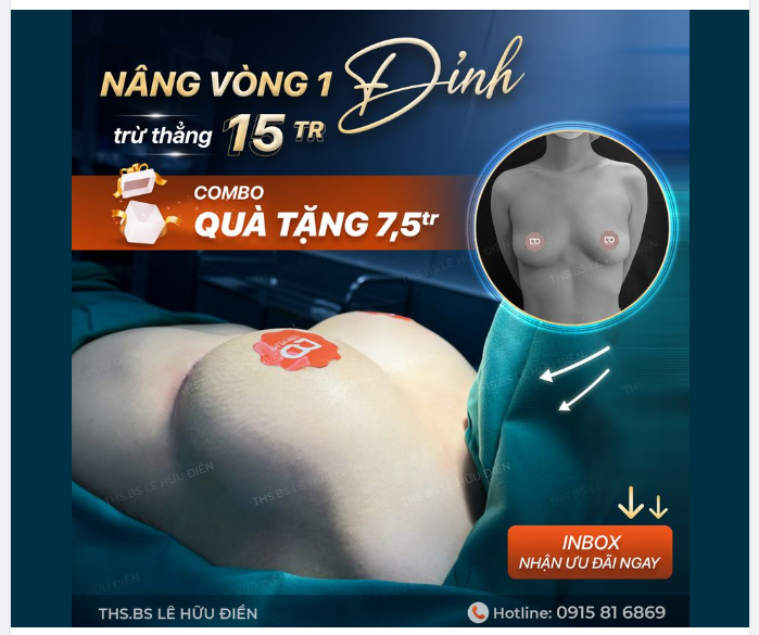 Siêu hot Trừ thẳng 15TR khi khách hàng đăng ký nâng V1 tại DrD