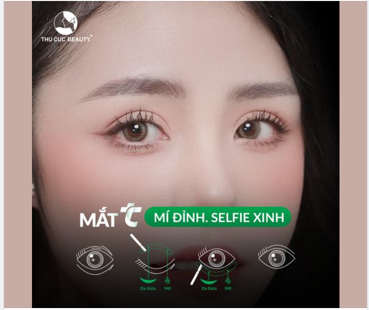 Loại bỏ mí lót, da chùng sau 15P Chọn mắt TC