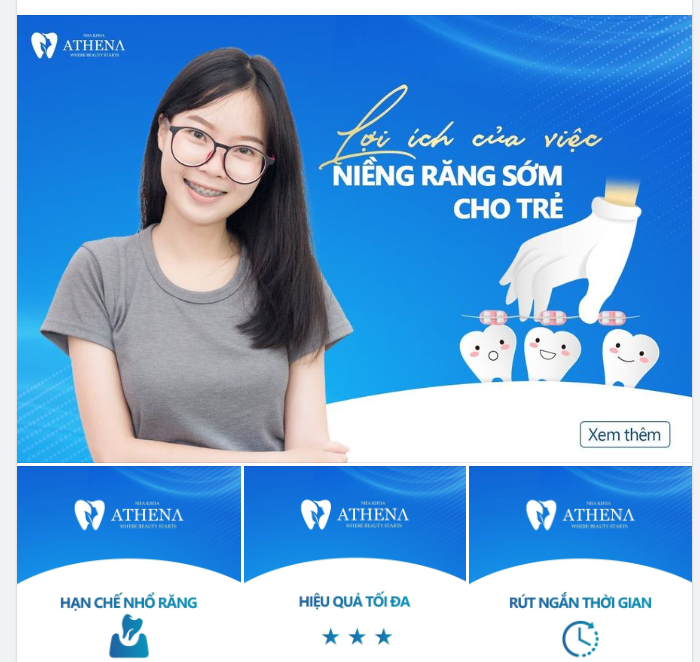 NIỀNG RĂNG - SỰ LỰA CHỌN TỐI ƯU CHO SỨC KHỎE RĂNG MIỆNG CỦA CON YÊU!
