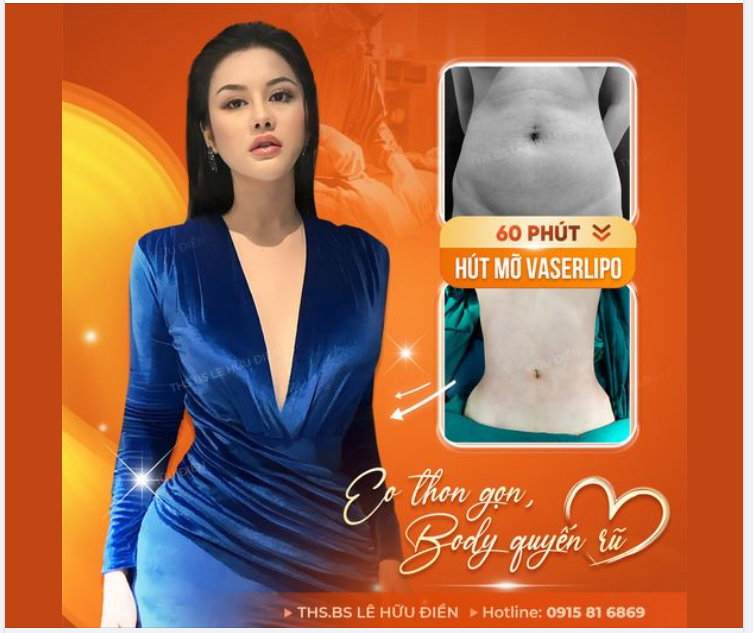 Công nghệ HÚT MỠ HIỆN ĐẠI Vaserlipo