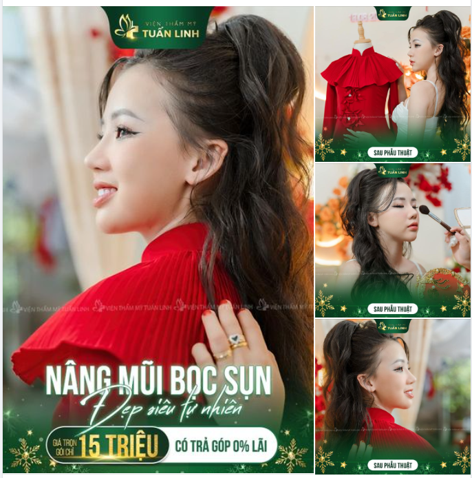 NÂNG MŨI BỌC SỤN - BỀN ĐẸP - TỰ NHIÊN