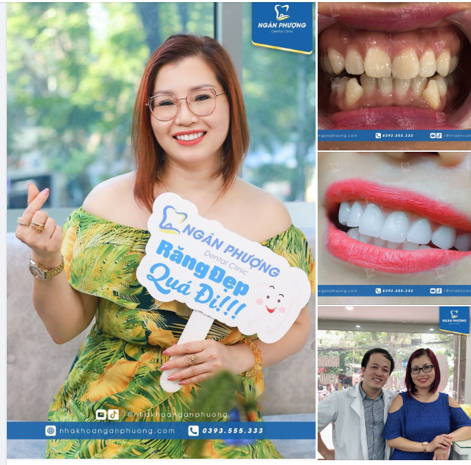 Có ai tin đây là bộ răng sứ từ 2018 không ạ?
