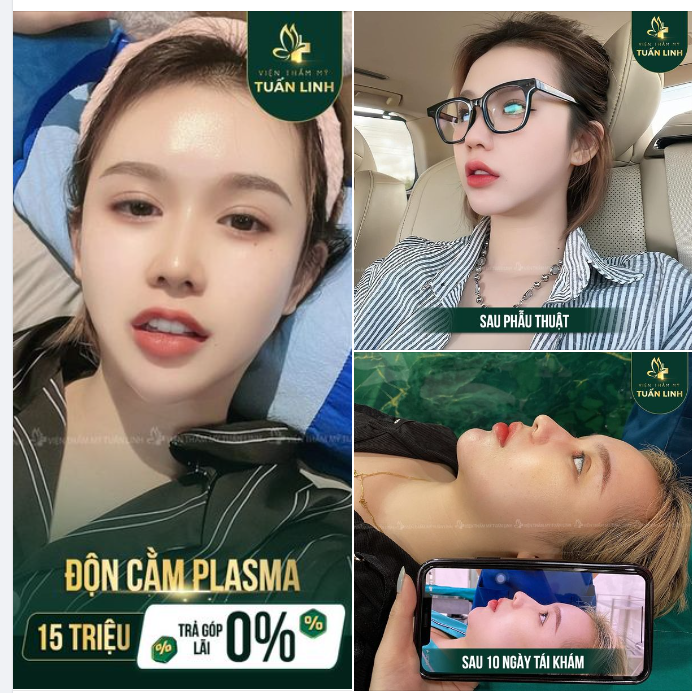 ĐỘN CẰM VLINE - CÔNG NGHỆ PLASMA - AN TOÀN - BỀN ĐẸP