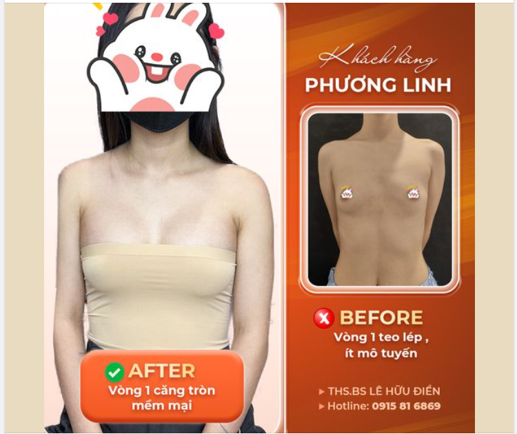 ''CHẤP'' MỌI KHUYẾT ĐIỂM TEO LÉP, CHẢY XỆ - VÒNG 1 CĂNG TRÒN QUYẾN RŨ CHỈ SAU 60P
