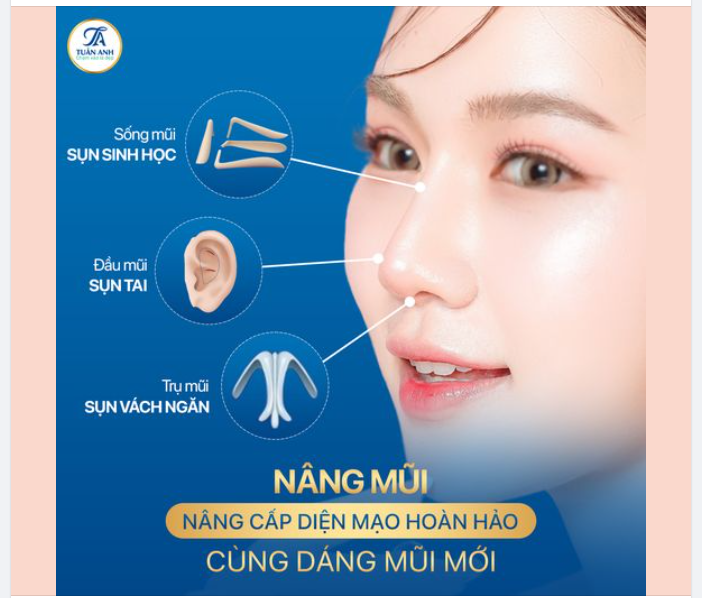 XINH ĐẸP BẤT NGỜ - CHỈ NHỜ NÂNG MŨI
