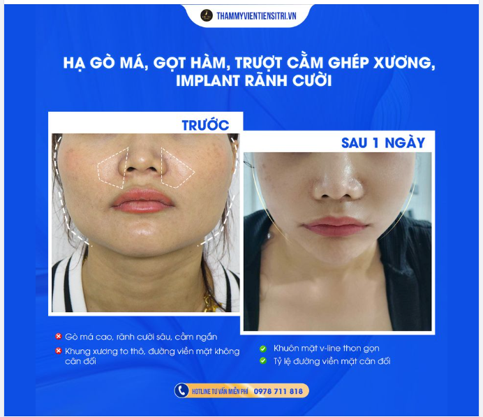 VẺ ĐẸP MỚI - NIỀM VUI MỚI