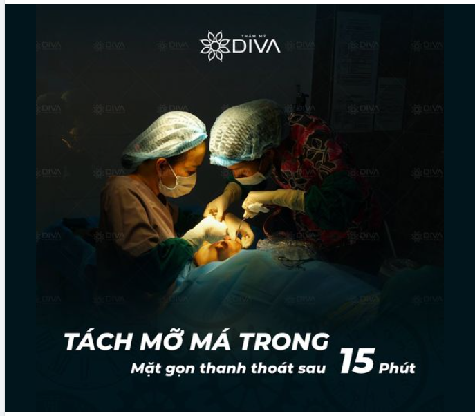 TÁCH MỠ MÁ TRONG – MẶT GỌN, THANH THOÁT SAU 15 PHÚT