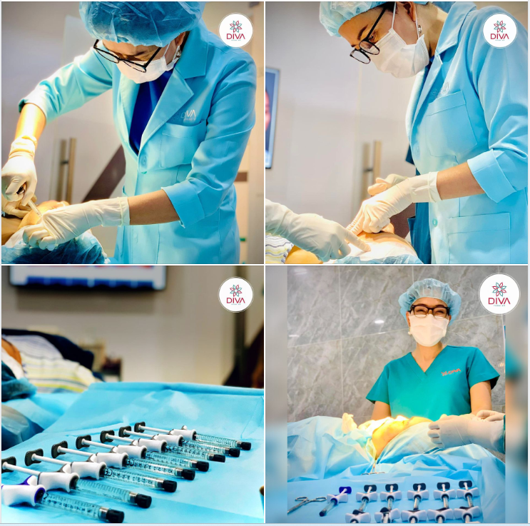 TIÊM FILLER MD CODES: ĐIỀU TRỊ CHẢY XỆ HIỆU QUẢ, KẾT QUẢ THẤY NGAY SAU KHI THỰC HIỆN