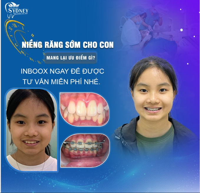 NIỀNG RĂNG CÓ ẢNH HƯỞNG ĐẾN SỰ PHÁT TRIỂN CỦA TRẺ KHÔNG?