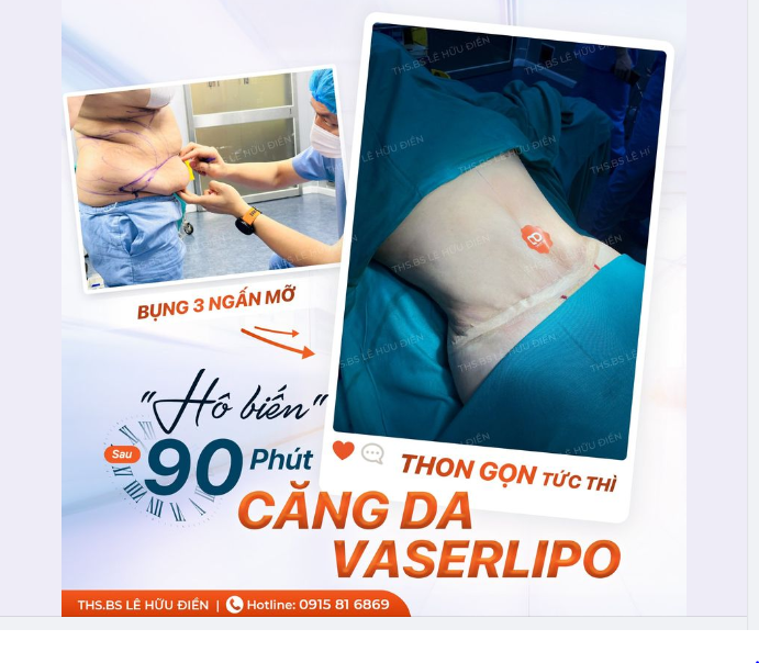 Ở đây không có mỡ thừa, ở đây chỉ có bụng nhỏ, eo thon