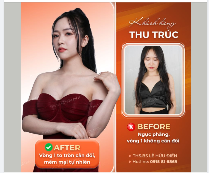 BÍ KÍP "HACK" VÒNG 1 CHỈ SAU 60P VỚI CÔNG NGHỆ NÂNG NGỰC HARMONIC