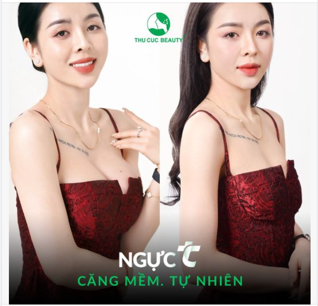 Hô biến V1 teo lép Căng tròn sau 60P