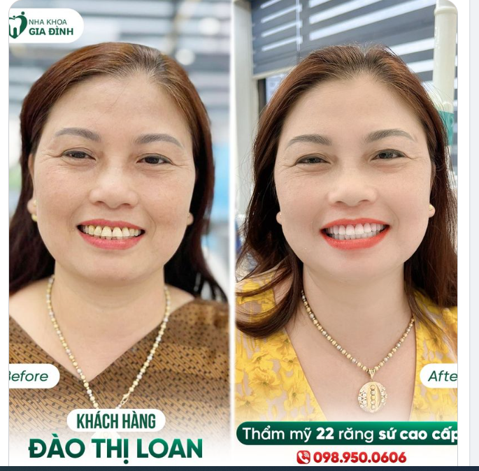 Bông hoa nào cũng cần được tưới nước để trở nên tươi tắn.