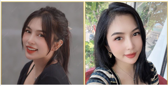 Chăm sóc, kiêng cữ như thế nào sau nâng mũi để có được kết quả như ý