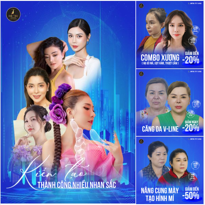 Khách hài lòng và có cuộc sống thành công với nhan sắc thăng hạng sau khi được Dr Trí tạo hình lại nhan sắc