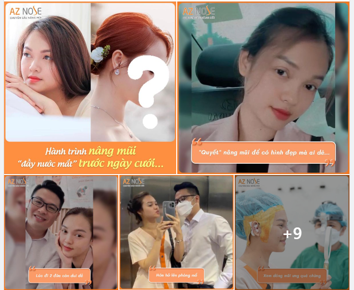 Hành trình nâng mũi để có bộ hình cưới “để đời” và cái kết…