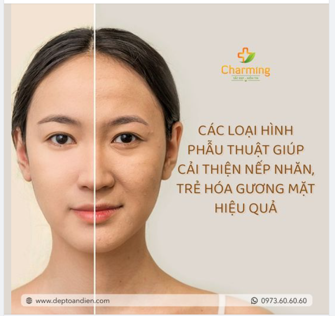 CÁC LOẠI HÌNH PHẪU THUẬT GIÚP CẢI THIỆN NẾP NHĂN, TRẺ HÓA GƯƠNG MẶT HIỆU QUẢ