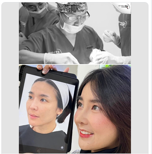 Dáng mũi không chỉ định hình nhan sắc, chiếc mũi trong nhân tướng học còn thể hiện đường công danh - tài lộc.