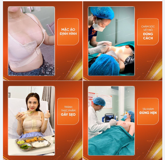 LƯU Ý CHĂM SÓC NGỰC SAU PHẪU THUẬT NÂNG V1