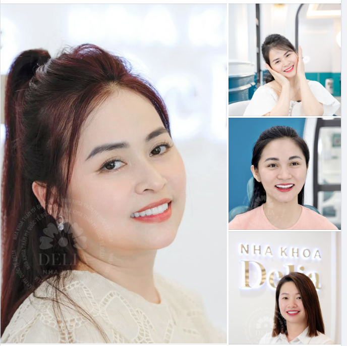 Trọn vẹn nụ cười rạng rỡ, khỏe đẹp của khách hàng tại Nha khoa Delia