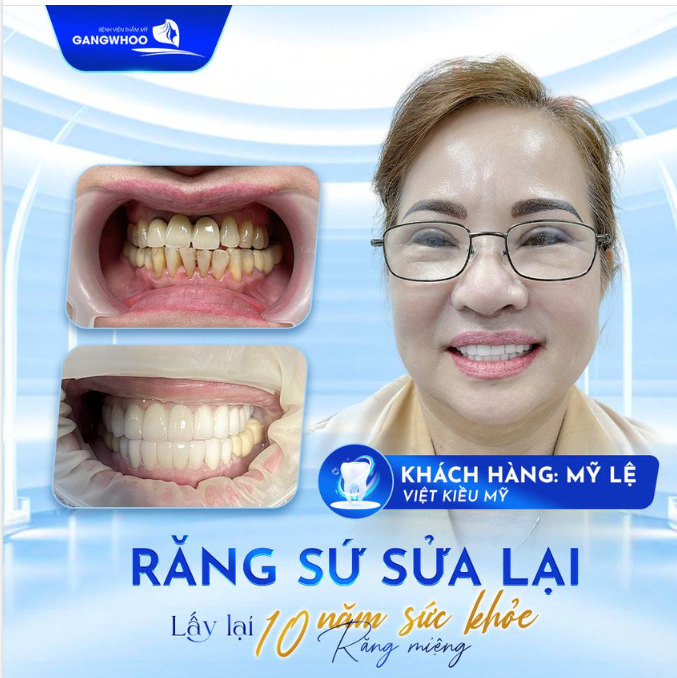 LẤY LẠI 10 NĂM THANH XUÂN VỚI HÀM RĂNG CHẮC KHỎE - DỄ DÀNG ĂN NHAI TUỔI XẾ CHIỀU