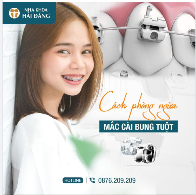 CÁCH PHÒNG TRÁNH MẮC CÀI BUNG TUỘT
