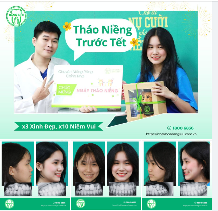 THÁO NIỀNG TRƯỚC TẾT - x10 NIỀM VUI