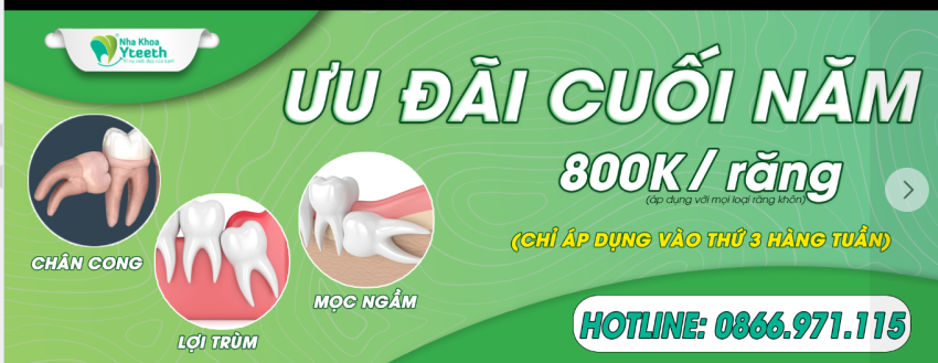 Nha Khoa Yteeth - Ưu Đãi Cuối Năm