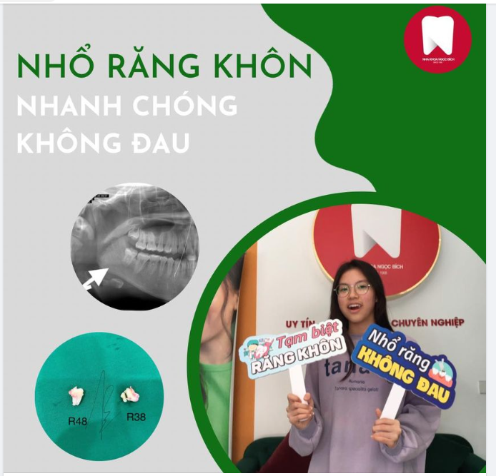 CHIA TAY RĂNG KHÔN TRONG ÊM ÁI NHỜ KỸ THUẬT HIỆN ĐẠI