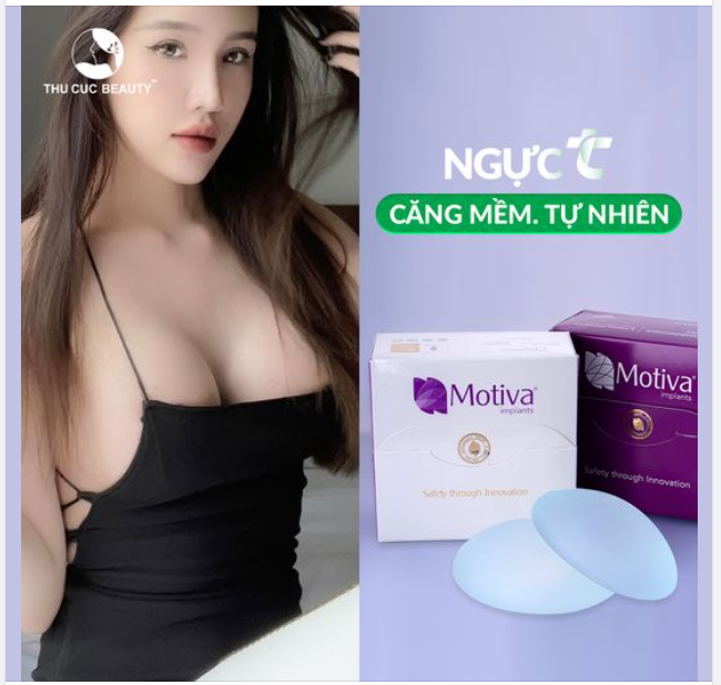 Nâng ngực Motiva căng mềm, đẹp tự nhiên