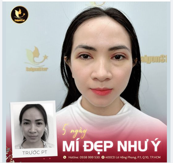 5 NGÀY MÍ ĐẸP NHƯ Ý