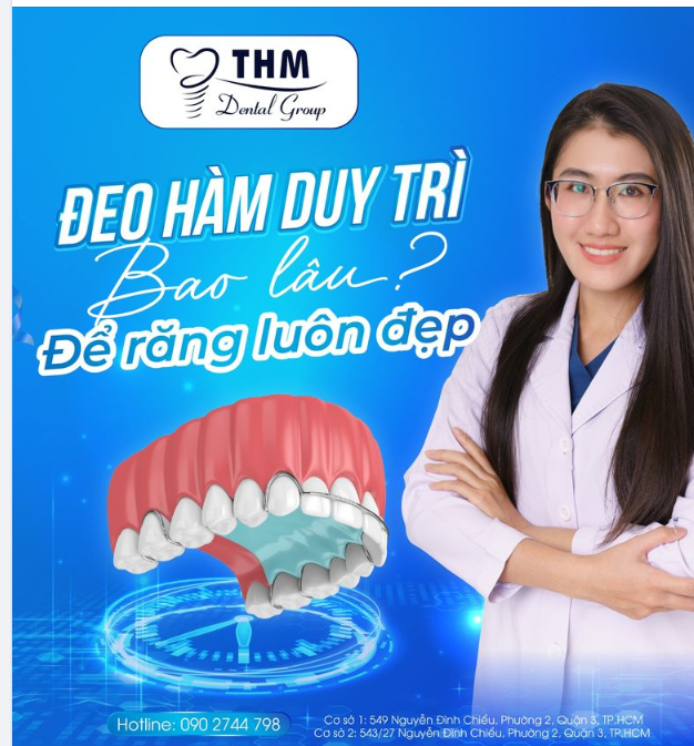 ĐEO HÀM DUY TRÌ BAO LÂU ĐỂ RĂNG LUÔN ĐỀU ĐẸP