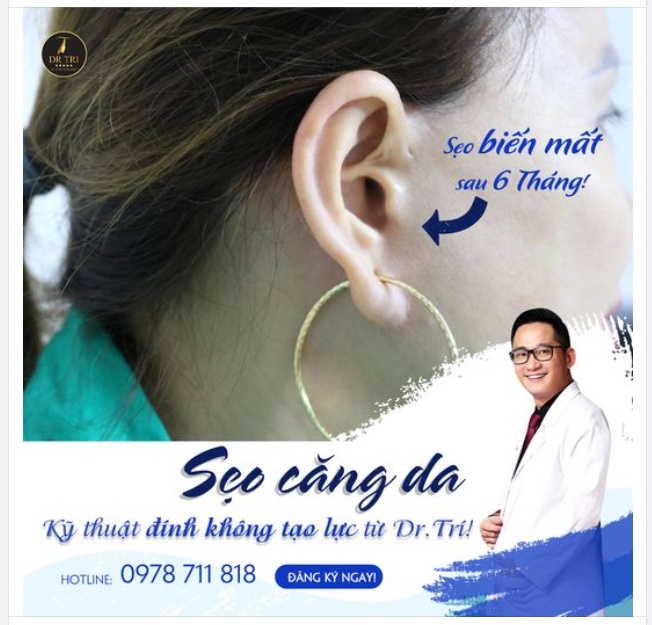 Chị khách nhà em CĂNG DA GIẤU SẸO tại Dr.Trí
