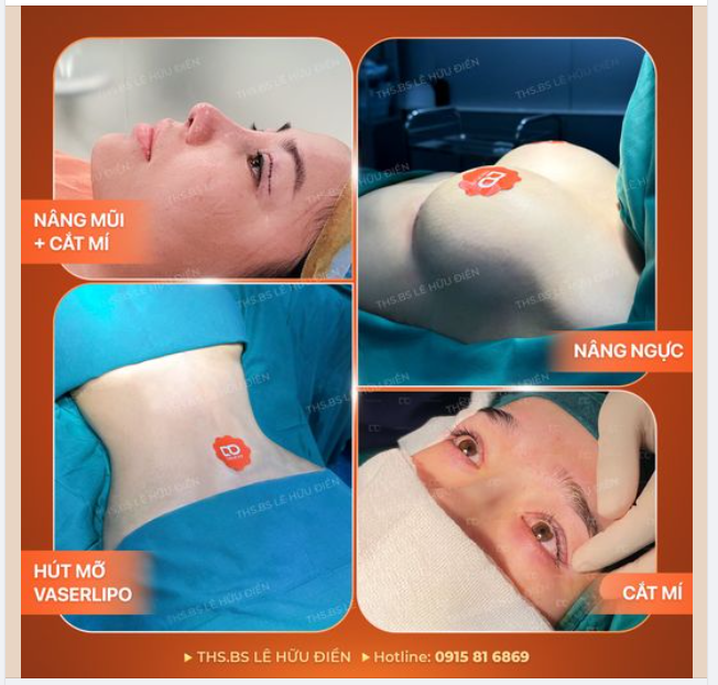 Tổng hợp các dịch vụ các chị em "mong muốn" thực hiện mỗi dịp Tết đến Xuân về.