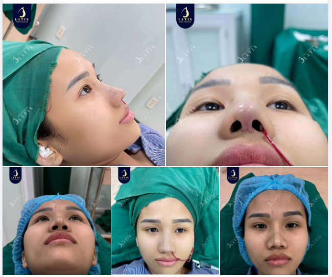 Chỉ còn hơn 1 tháng nữa là Tết rồi, chị em đã sẵn sàng cho diện mạo xinh đẹp chưa