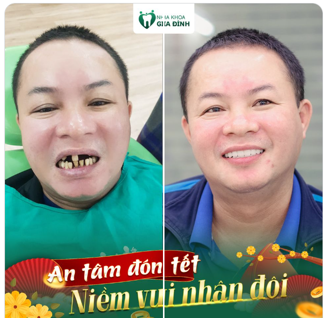 AN TÂM ĐÓN TẾT - NIỀM VUI NHÂN ĐÔI