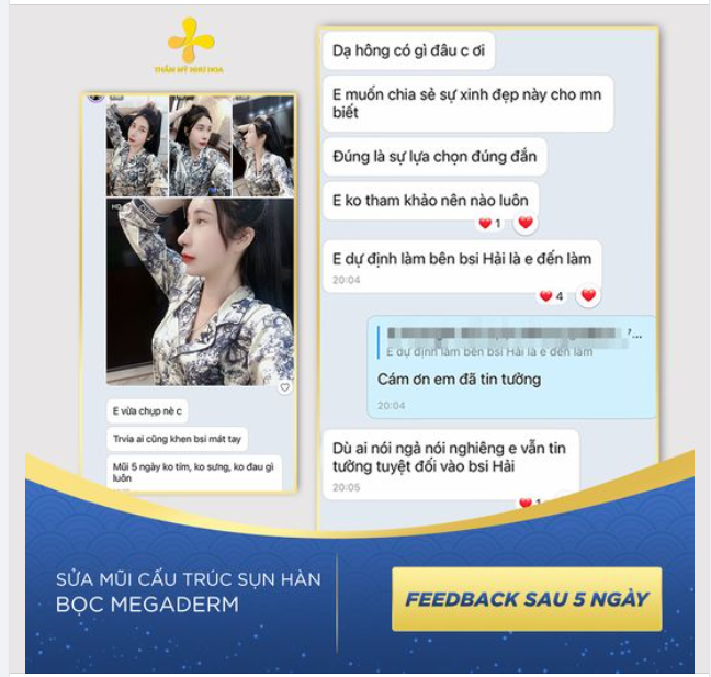 “Bác sĩ mát tay. Mũi 5 ngày không sưng, không tím, không đau. Đúng là sự lựa chọn đúng đắn".