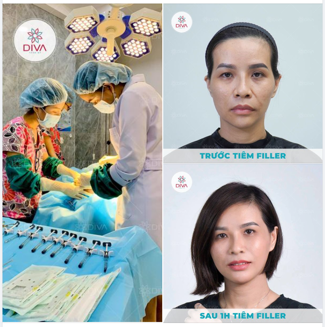 PHƯƠNG PHÁP NÀO NGĂN NGỪA LÃO HÓA ĐỘNG HIỆU QUẢ?