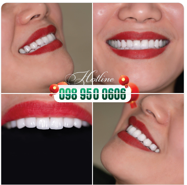 Với chị em phụ nữ, làm đẹp chưa bao giờ là đủ.